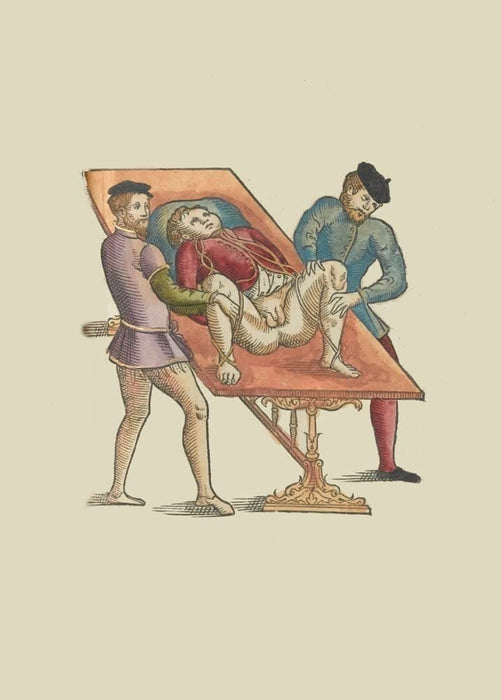 Vintage Anatomy 'Bladder Stone Removal', from 'Surgical Instruments, Procedures and Artificial Body Parts', France, 1564, Ambroise Pare, Reproduction 200gsm A3 Vintage Medical Poster
