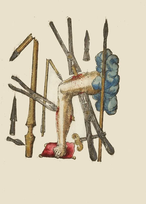 Vintage Anatomy 'Wounds Inflicted by Weapons', from 'Surgical Instruments, Procedures and Artificial Body Parts', France, 1564, Ambroise Pare, Reproduction 200gsm A3 Vintage Medical Poster