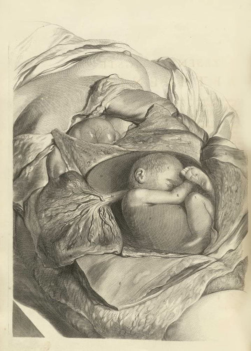 Vintage Anatomy 'Fetus', from 'Anatomia Humani Corporis', 1685, Netherlands, Govard Bidloo, Gerard de Lairesse, Reproduction 200gsm A3 Vintage Medical Poster