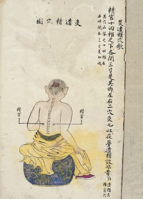 Vintage Anatomy Acupuncture 'Moxibustion Jinggong Point, Palace of Esssence Semen', from 'Record of Soverign Teachings. A Treaties on Acu-Moxa', China, 1869, Reproduction 200gsm A3 Vintage Medical Acupuncture Poster